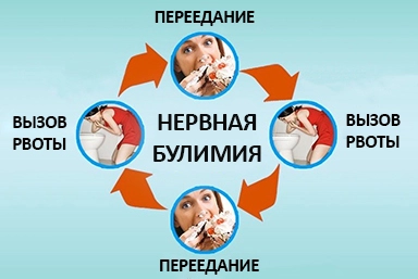 Лечение булимии в Воскресенске